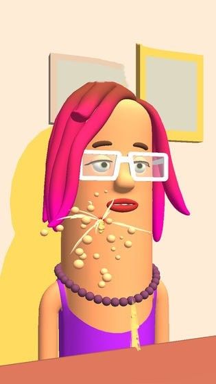 我爱挤痘痘中文版下载