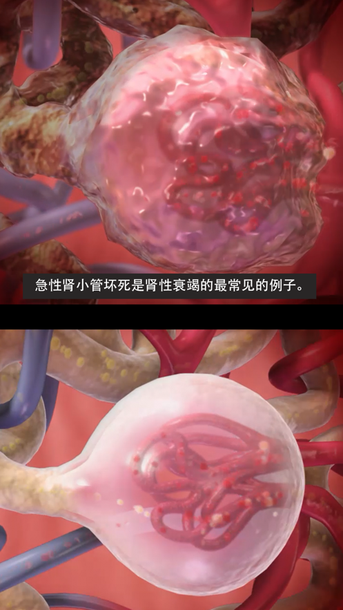 Physiology Pathology中文破解下载