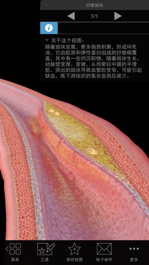 Physiology Pathology中文破解下载